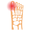 Gregory Kern - Pathologie - Prestation au centre du mouvement